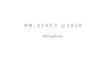 Rhinoplasty 